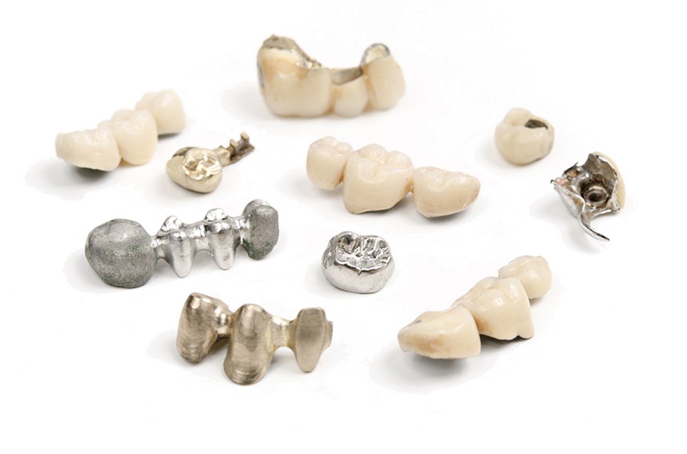 Matériau de couronne temporaire dentaire 120 pièces pour 50 molaires et 70  placages de dents antérieures 